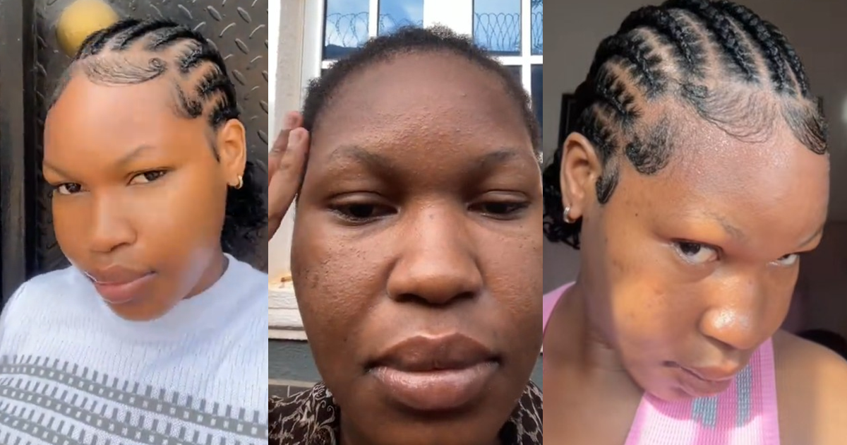 Lady súffers from face rashes after keeping braids in for 10 weeks (WATCH)